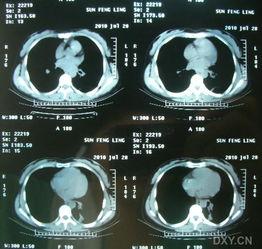 阴超镜视频,女性生殖健康全景扫描